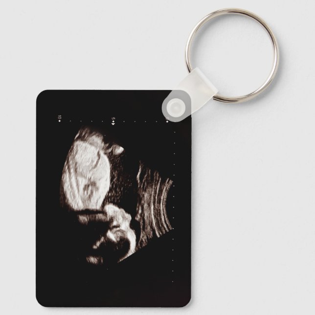 Personlig Baby Ultrasound Nyckelring (Baksida)