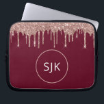 Personlig Burgundy Ro Guld Glitter Drivrutiner<br><div class="desc">Girly  Rosa - Ro Guld och Black Faux Glitter Drips och Gnistra Elegant Monogrammed Initialer Fodral. Fodral kan anpassas så att det omfattar ditt första och första namn.</div>