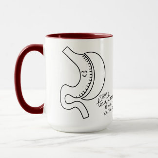 Personlig Gastric Sleeve Barimic Surgery Date Mugg