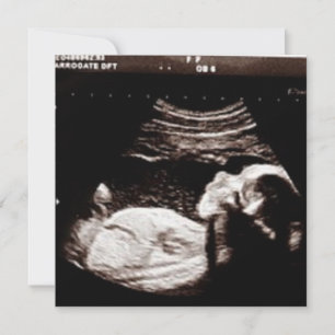 Personlig Ultrasound Bild Baby Shower Inbjudningar