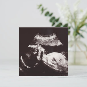 Personlig Ultrasound Bild Baby Shower Inbjudningar