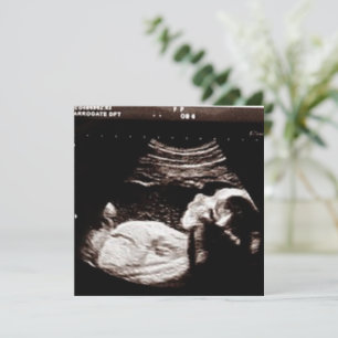 Personlig Ultrasound Bild Baby Shower Inbjudningar