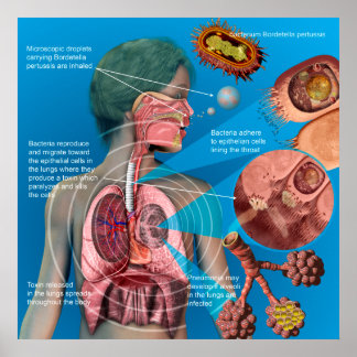 Pertussis (Hunghosta) poster