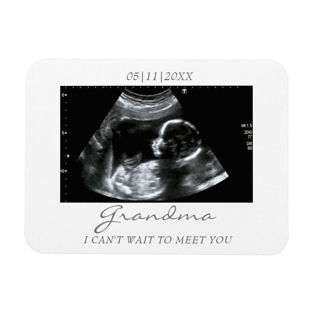 Photo Magnet Ultrasound Gifts for Grandma Sonogram (Horisontell)