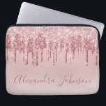 Pink Rose Gold Glitter Sparkle Monogram Laptop Fodral<br><div class="desc">Rosa - Ro Guld Faux-Sleeve- som kör Glitter och Gnistra Elegant Monogram Girly Cute Computer Fodral eller . Det här fodral kan anpassas så att du inkluderar ditt namnteckning skript namn.</div>