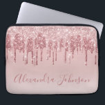 Pink Rose Gold Glitter Sparkle Monogram Laptop Fodral<br><div class="desc">Rosa - Ro Guld Faux-Sleeve- som kör Glitter och Gnistra Elegant Monogram Girly Cute Computer Fodral eller . Det här fodral kan anpassas så att du inkluderar ditt namnteckning skript namn.</div>