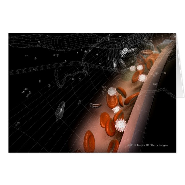 Plaque in the arteries hälsningskort (Framsidan Horizontal)