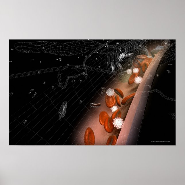 Plaque in the arteries poster (Framsidan)