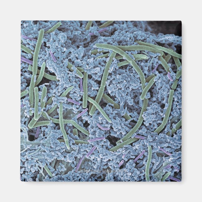 Plast, färgad, elektronskanning magnet (Framsidan)