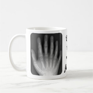 Polydactyl räcka röntgenstrålen kaffemugg