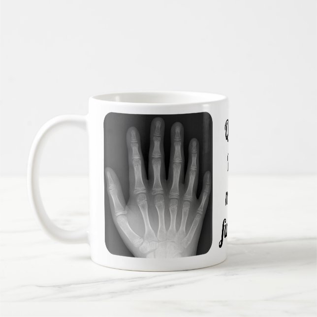 Polydactyl räcka röntgenstrålen kaffemugg (Vänster)