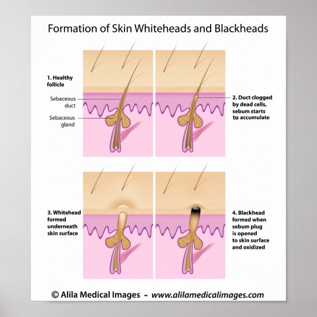 Poster (Framsidan)