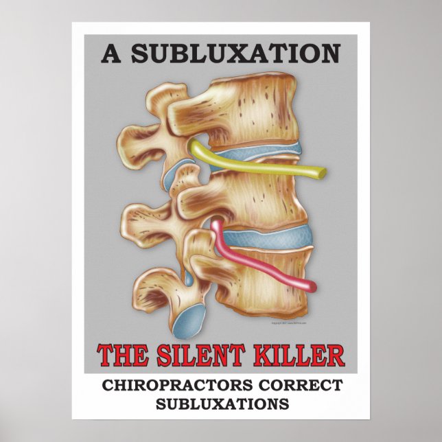 Poster av chiropraktisk subluxation, tyst Killer (Framsidan)