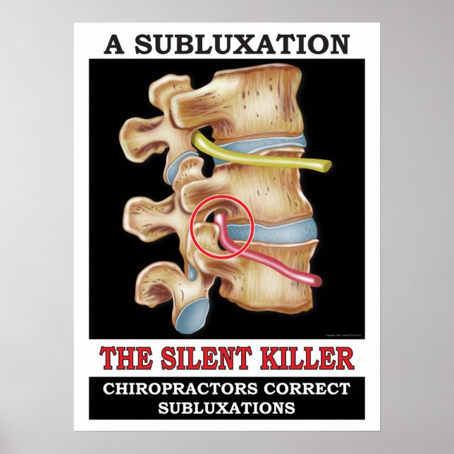 Poster av kretskoppling med Vertebral subluxation (Framsidan)