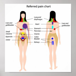 Poster refererat smärtdiagram