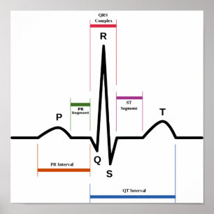 Poster Sinusrytm EKG-diagram med elektrokardiogram