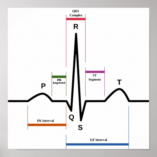 Poster Sinusrytm EKG-diagram med elektrokardiogram (Framsidan)