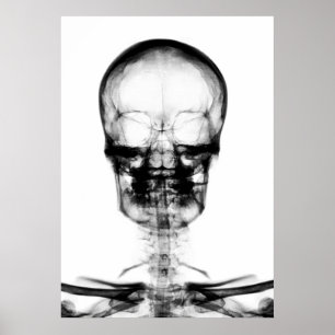 POSTER/SKRIV UT X RAY VISION SKELETON SKULL - B&W POSTER