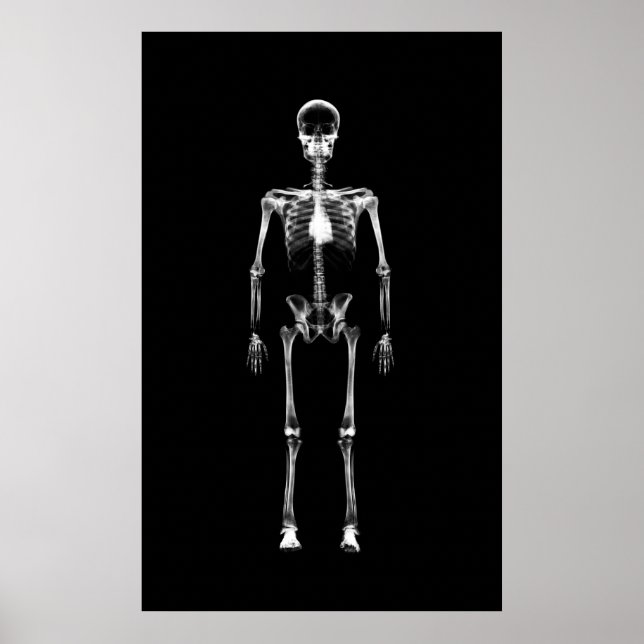 Poster - svartvit X-Ray Vision med en Skeleton (Framsidan)