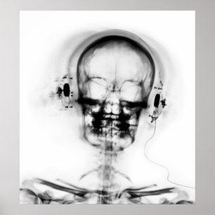POSTER-X-RAY MUSIC SKELETON BLACK GRÅTT B&W POSTER