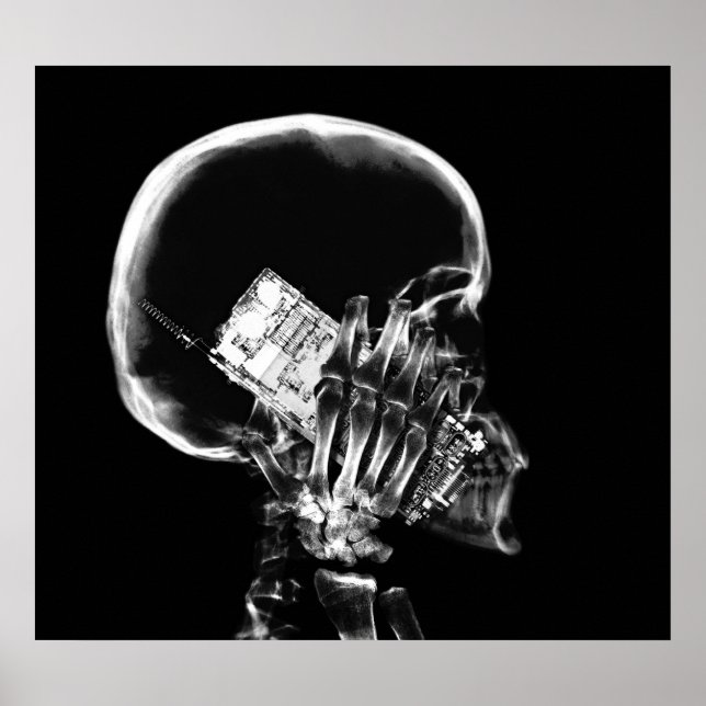 POSTER - X RAY SKELETON PÅ MOBILT BLK GRÅTT (Framsidan)