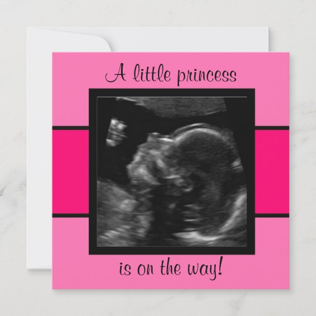 Princess Baby Customized Ultrasound Photo Template Inbjudningar (Framsida)