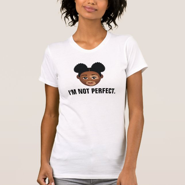 #Proud2BNaturalMe perfekt Vitiligo T Shirt (Framsida)
