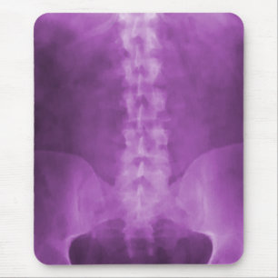 Purpurfärgade Digital röntgar konst Mousepad Musmatta