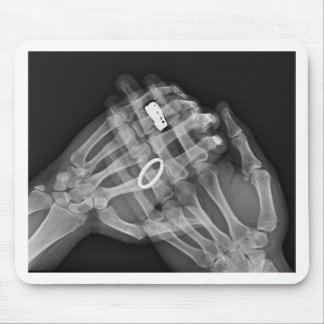 Räcka innehav musmatta