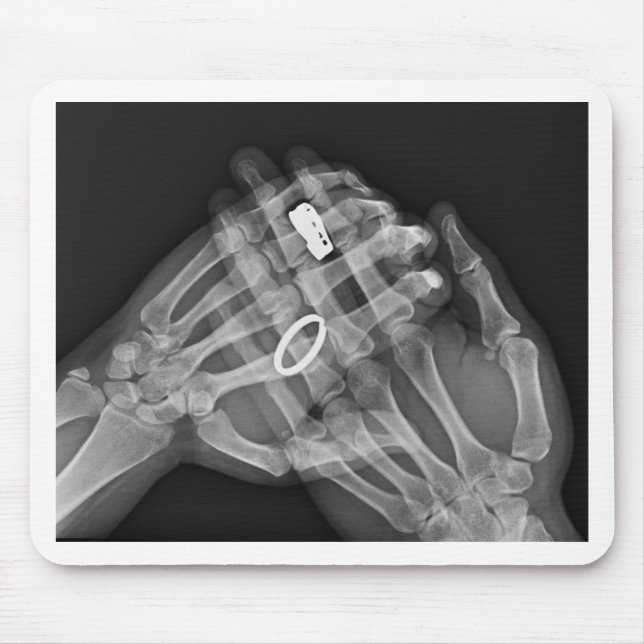 Räcka innehav musmatta (Framsidan)