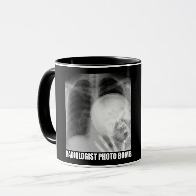 RADIOLOGISKT FOTOBOMB MUGG (Framsida vänster)