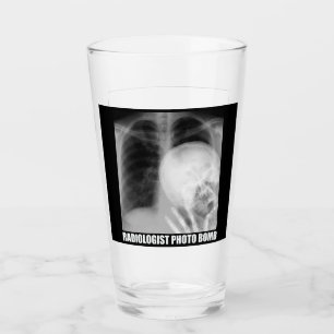 RADIOLOGIST PHOTO BOMB GLASKOPP