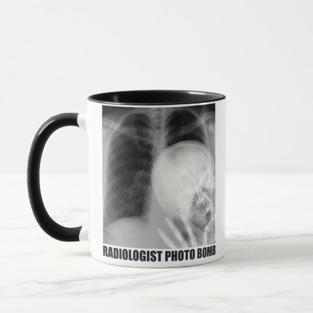 RADIOLOGIST PHOTO BOMB MUGG (Vänster)
