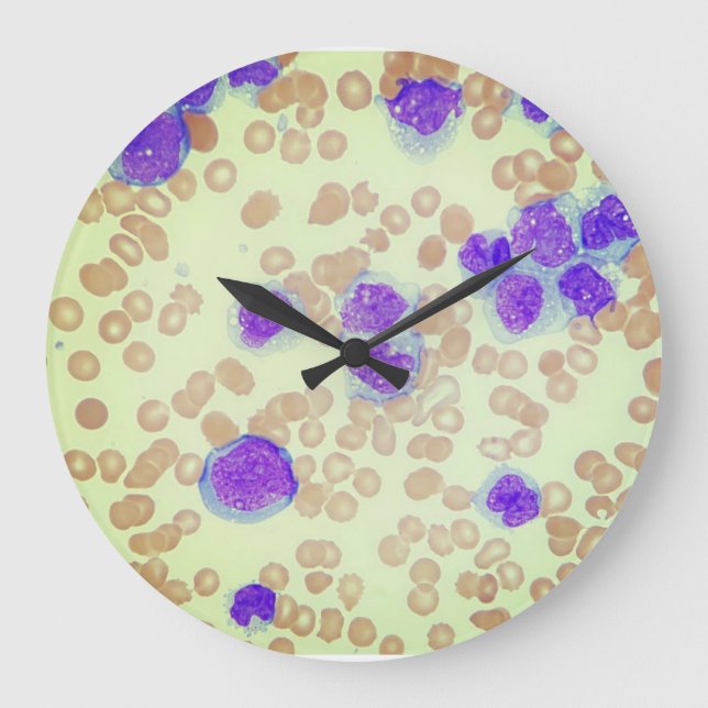 RBCs WBCs Slide Microscope Hematology Lab Stor Klocka (Framsida)