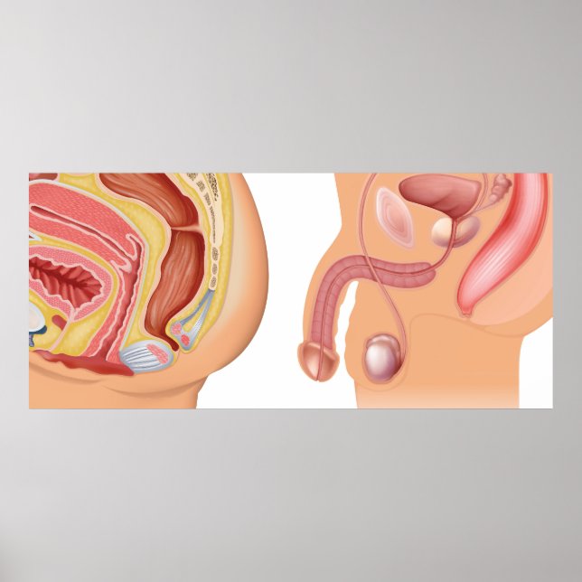 Reduktionssystem för kvinnor och män poster (Framsidan)