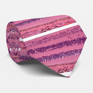 ReTIEna (näthinnehistologi) Slips