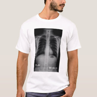 “Retro VHS Röntgen” Gammaldags lungröntgen med VHS T Shirt