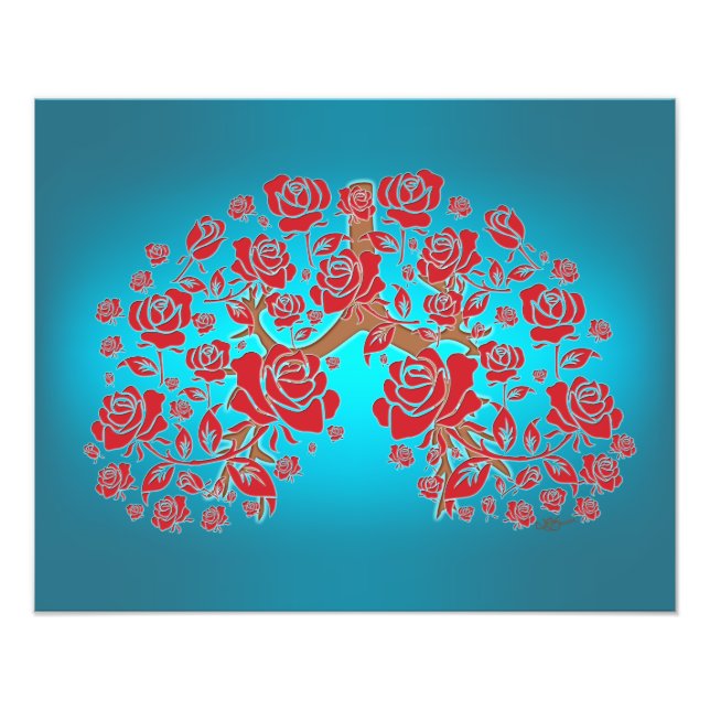 Ro & Hope Fototryck (Framsidan)