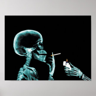 Rökröntgenposter Poster