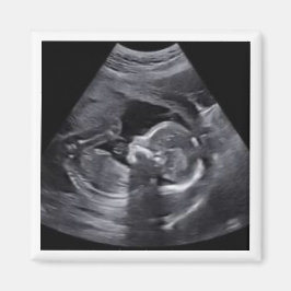 Roligt av gravida Sonogram fototids Keepsaki Magnet