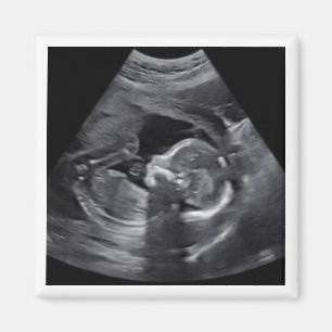 Roligt av gravida Sonogram fototids Keepsaki Magnet