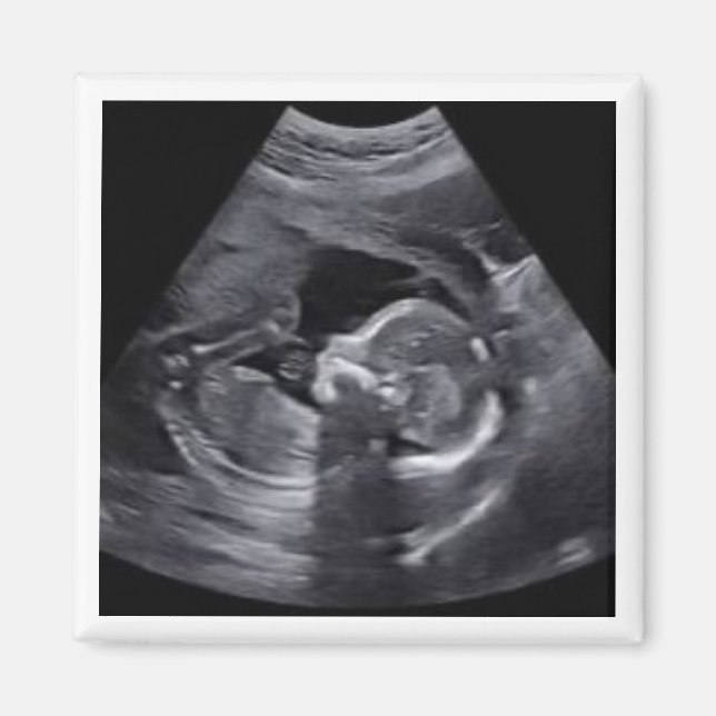 Roligt av gravida Sonogram fototids Keepsaki Magnet (Framsidan)