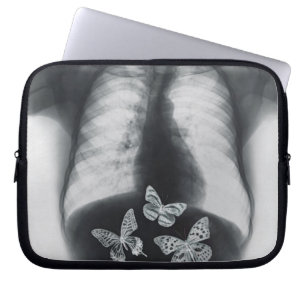 Röntga av fjärilar i magen laptop sleeve