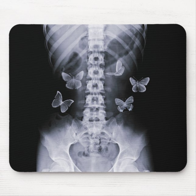 Röntga begreppsmässiga fjärilar Mousepad Musmatta (Framsidan)