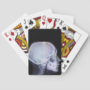 Röntga leka kort casinokort