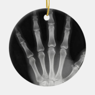 RÖNTGA SKELETT RÄCKER FINGRAR B&W JULGRANSPRYDNAD KERAMIK
