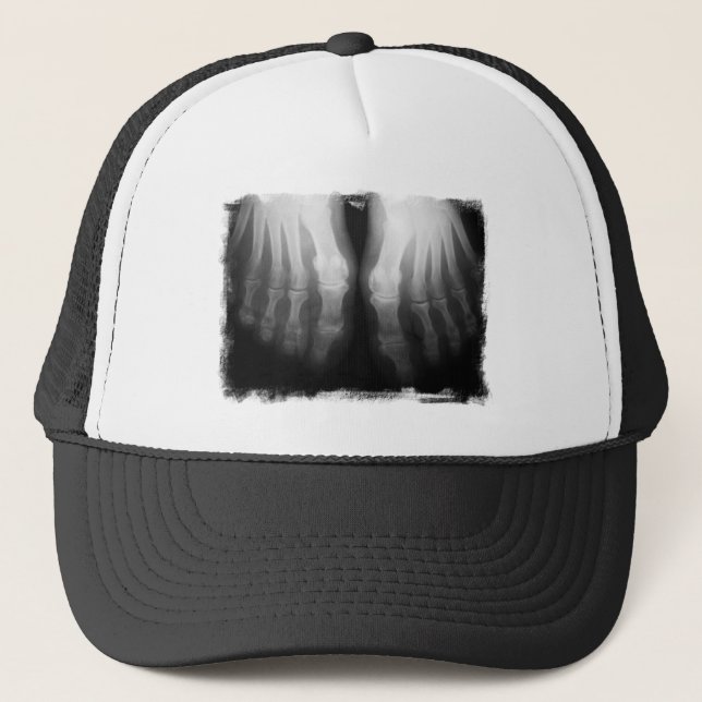 Röntga svarten & vit för ben för fotmänniska den keps (Framsida)