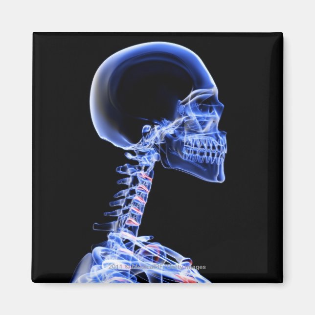 Röntgen på benen i nacke magnet (Framsidan)