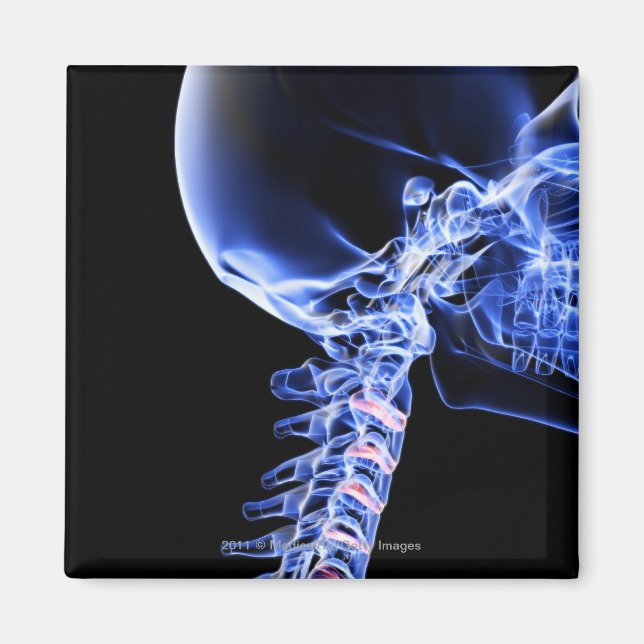 Röntgenbild av benen i nacke magnet (Framsidan)