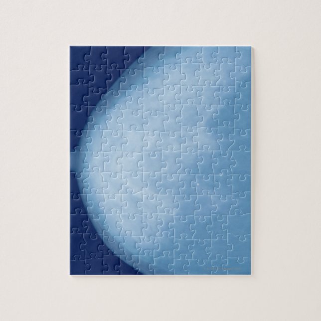 röntgenbild av kvinnligt bröst, biseende pussel (Vertikal)